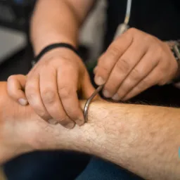 Praca z tkankami miękkimi stopy przy użyciu narzędzia IASTM przez terapeutę, widoczny zegarek na nadgarstku terapeuty i logo firmy na nodze pacjenta.