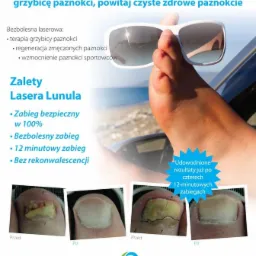 leczenie grzybicy i regeneracja paznokci laserem