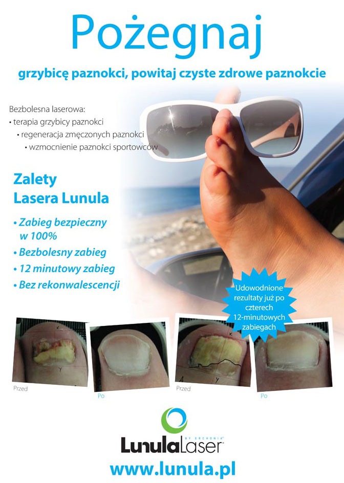 leczenie grzybicy i regeneracja paznokci laserem