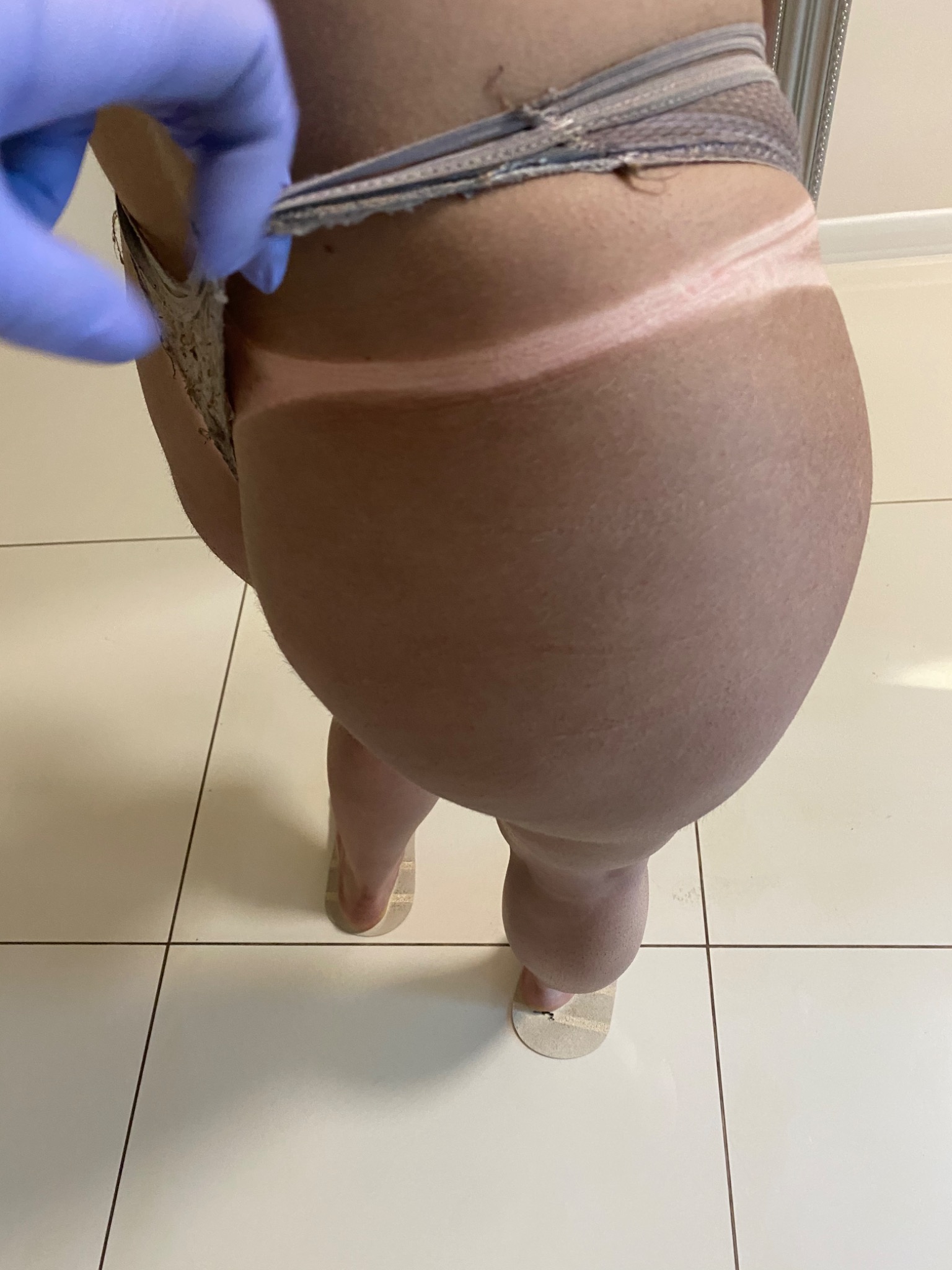 Klientka po zabiegu opalania natryskowego w salonie w Suchej Beskidzkiej, widoczny efekt opalenizny i linia po bikini. Ręka w niebieskiej rękawiczce kosmetyczki poprawia strój.