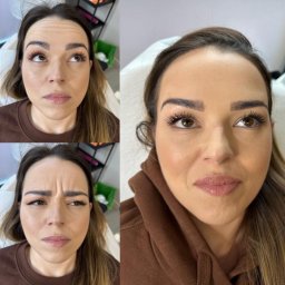 Medycyna estetyczna Radom 1