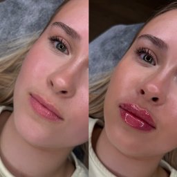 Medycyna estetyczna Radom 2