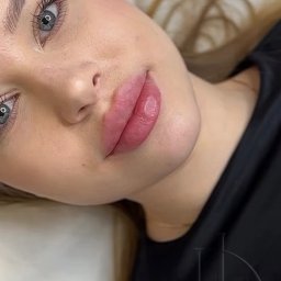 Medycyna estetyczna Radom 3