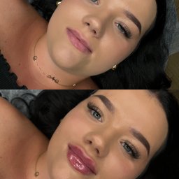 Medycyna estetyczna Radom 4