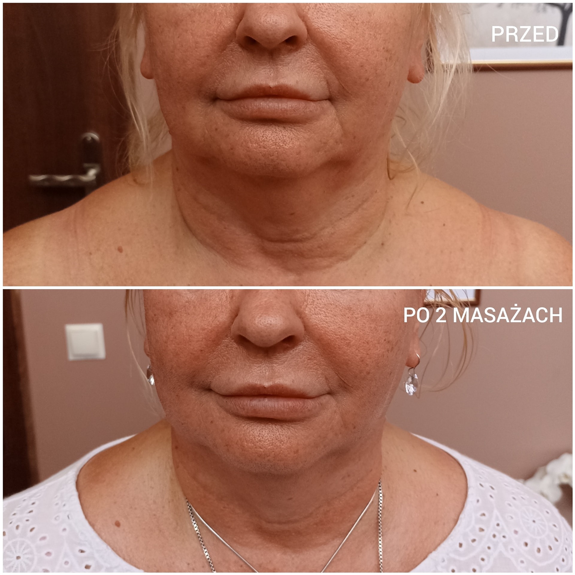 kobido-masaz-twarz-szczecin-naturatwarzy