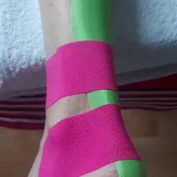Kinesiotaping ścięgna Achillesa.