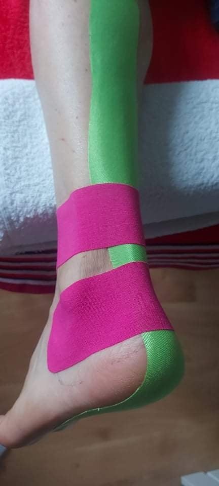 Kinesiotaping ścięgna Achillesa.