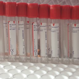Testy na p/ciała po przechorowaniu covid19 oraz na odpowiedź immunologiczną po szczepieniu