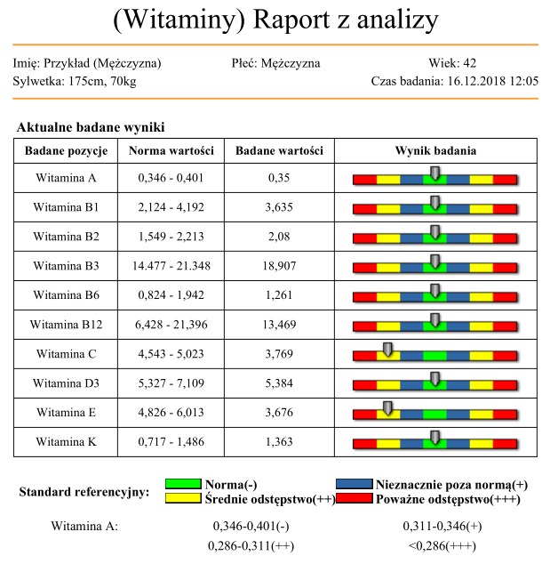 Raport z analizy poziomu witamin, prezentujący wyniki badań dla witamin A, B1, B2, B3, B6, B12, C, D3, E i K, z zaznaczonymi normami i odchyleniami od normy.