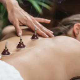 Masaż pleców z użyciem moksoterapii: trzy moksaterapeutyczne bańki z tlącymi się stożkami na skórze pacjentki, dłonie masażysty delikatnie dotykają pleców, w tle zielone rośliny.