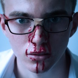 Dawid Morris - Portret młodego mężczyzny we Wrocławiu z krwawiącym nosem i plastrami, noszącego okulary i białą koszulę, w chłodnym oświetleniu.