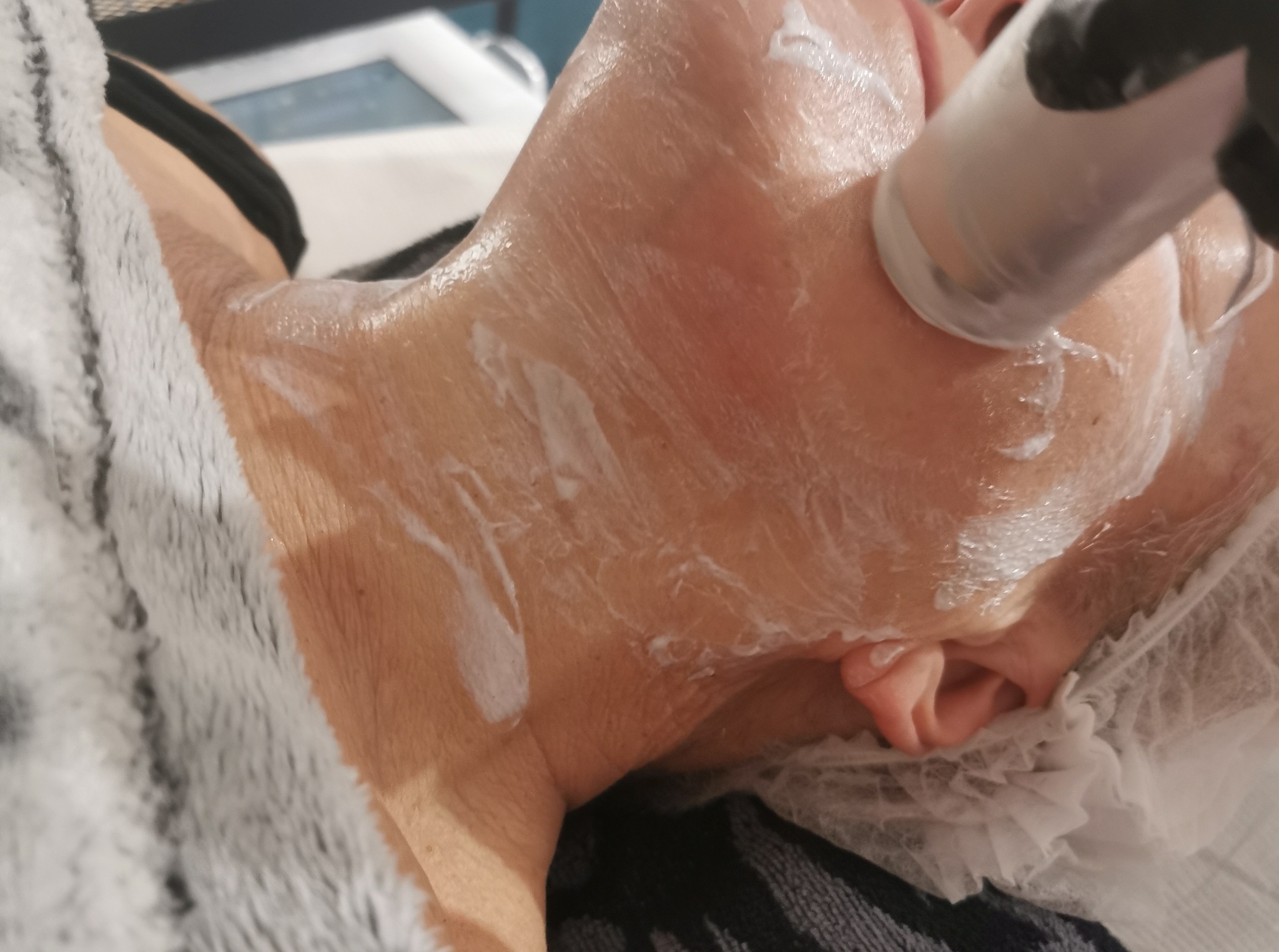 Zabieg na twarz z użyciem urządzenia nałożonego na skórę pokrytą kremem, widoczna część twarzy pacjenta w czepku ochronnym i ręka osoby wykonującej zabieg w czarnej rękawiczce.