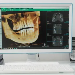 Ekran komputera prezentuje trójwymiarowy rentgenowski obraz szczęki pacjenta w gabinecie lekarskim.