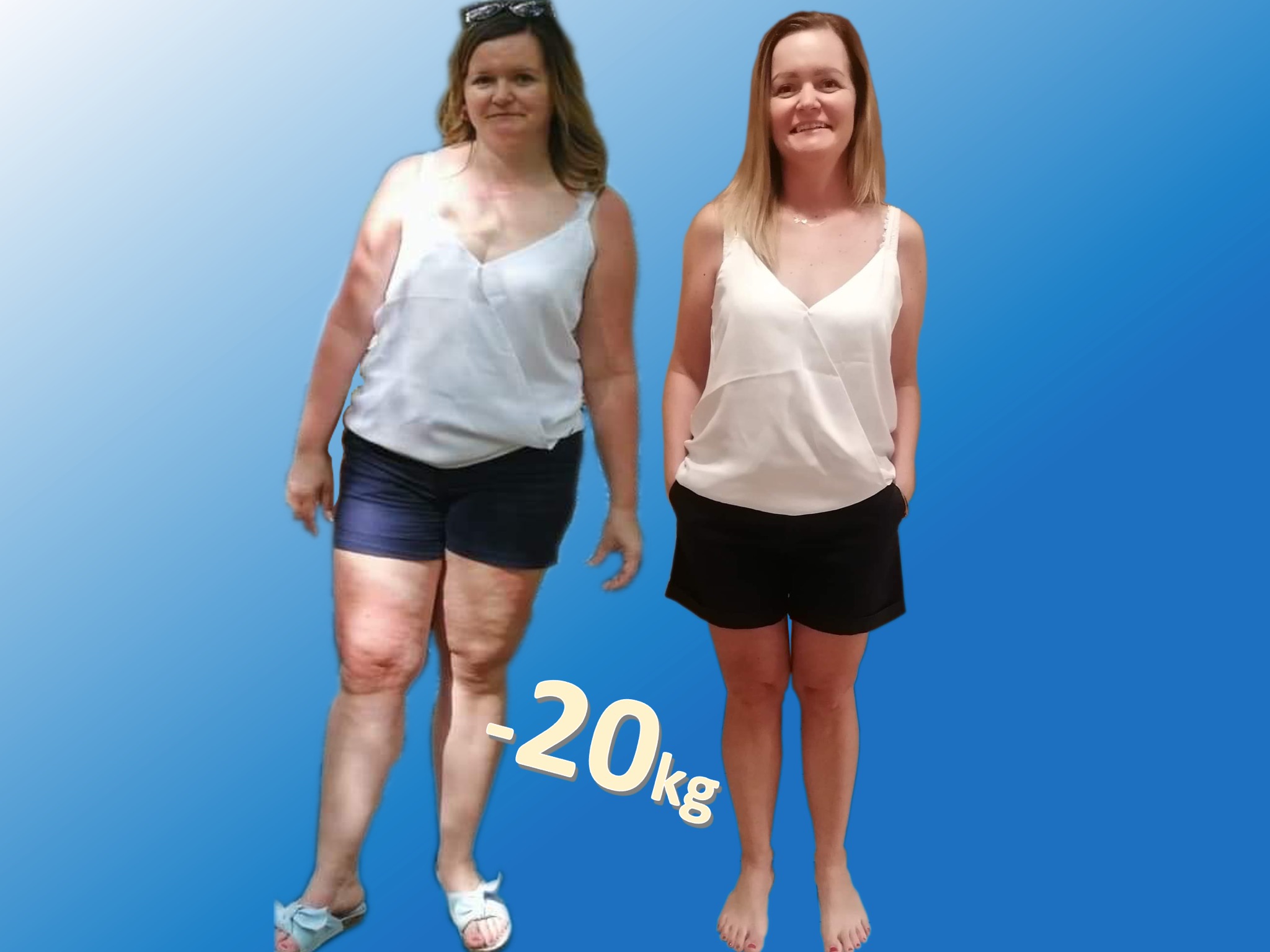 Kobieta przed i po utracie wagi, widoczne porównanie sylwetki, z zaznaczoną różnicą -20 kg.