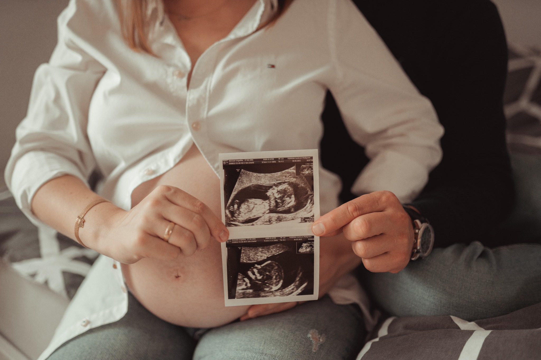 Przyszła mama w rozpiętej białej koszuli, trzymająca zdjęcia USG w objęciach partnera, widoczne detale: złota bransoletka i zegarek na ręce