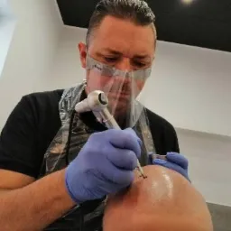 Mikropigmentacja skóry głowy wykonywana przez mężczyznę w ochronnej masce i rękawicach, widoczny specjalistyczny sprzęt.