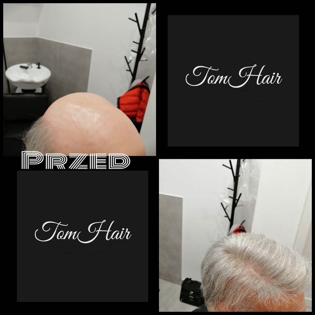 Zdjęcie 'przed' z Garwolina prezentujące efekt przed zabiegiem fryzjerskim, widoczny fragment łysiny na głowie klienta, logo salonu Tom Hair i fragment wyposażenia salonu.