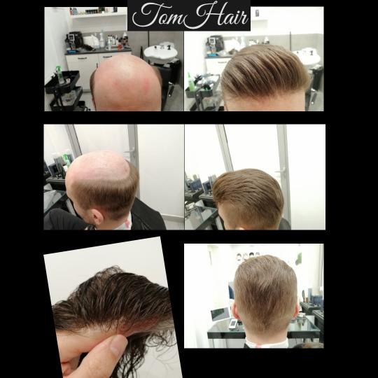 Przed i po: Męska peruka częściowa, ukazująca proces aplikacji i efekt końcowy z bliska.