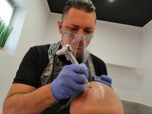 Mikropigmentacja skóry głowy wykonywana przez mężczyznę w ochronnej masce i rękawicach, widoczny specjalistyczny sprzęt.