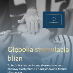 Głęboka stymulacja blizn 