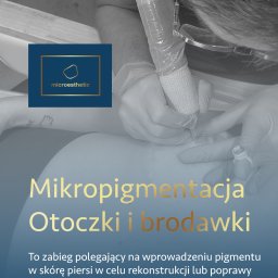 Mikropigmentacja otoczki i brodawki 
Microesthetic Poznań