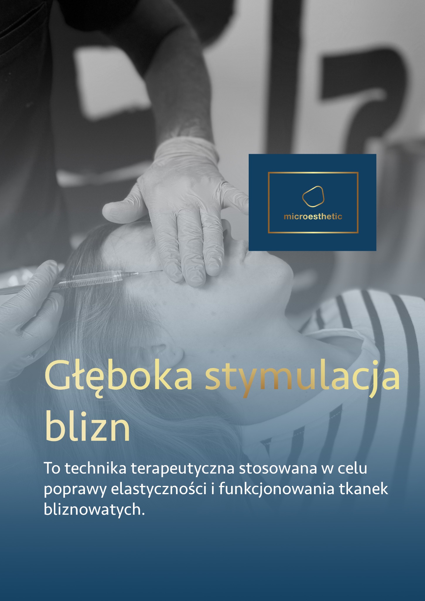 Głęboka stymulacja blizn