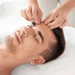 Akupunktura Częstochowa 2