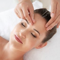 Akupunktura Częstochowa 1