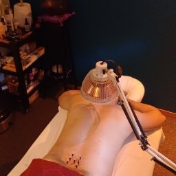 Akupunktura Ruda Śląska 2