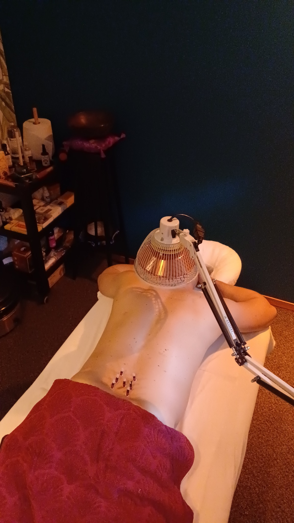 Pacjent leżący na brzuchu na białym prześcieradle, z wbitymi igłami w dolnej części pleców, ogrzewany lampą grzewczą z metalową osłoną. Czerwony ręcznik zakrywa dolną część ciała. W tle widoczny...