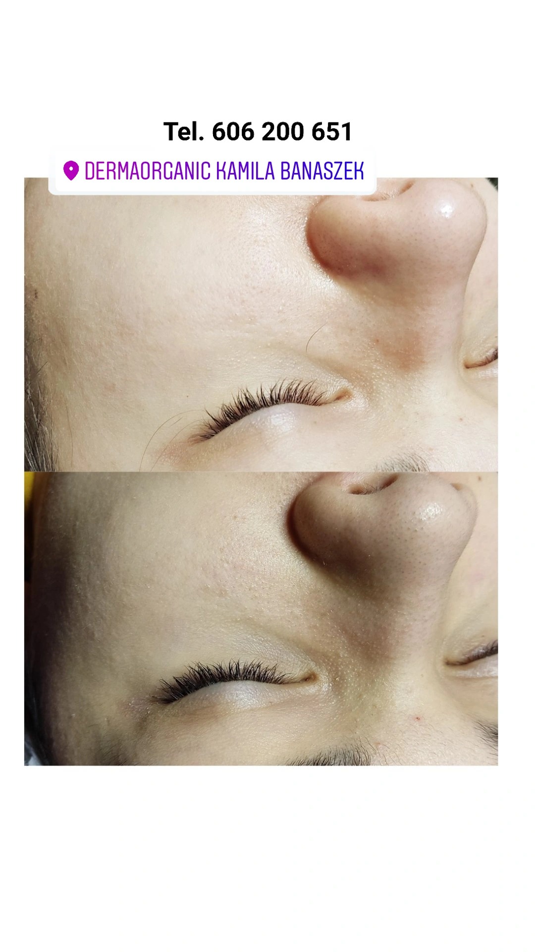 oczyszczanie wodorowe