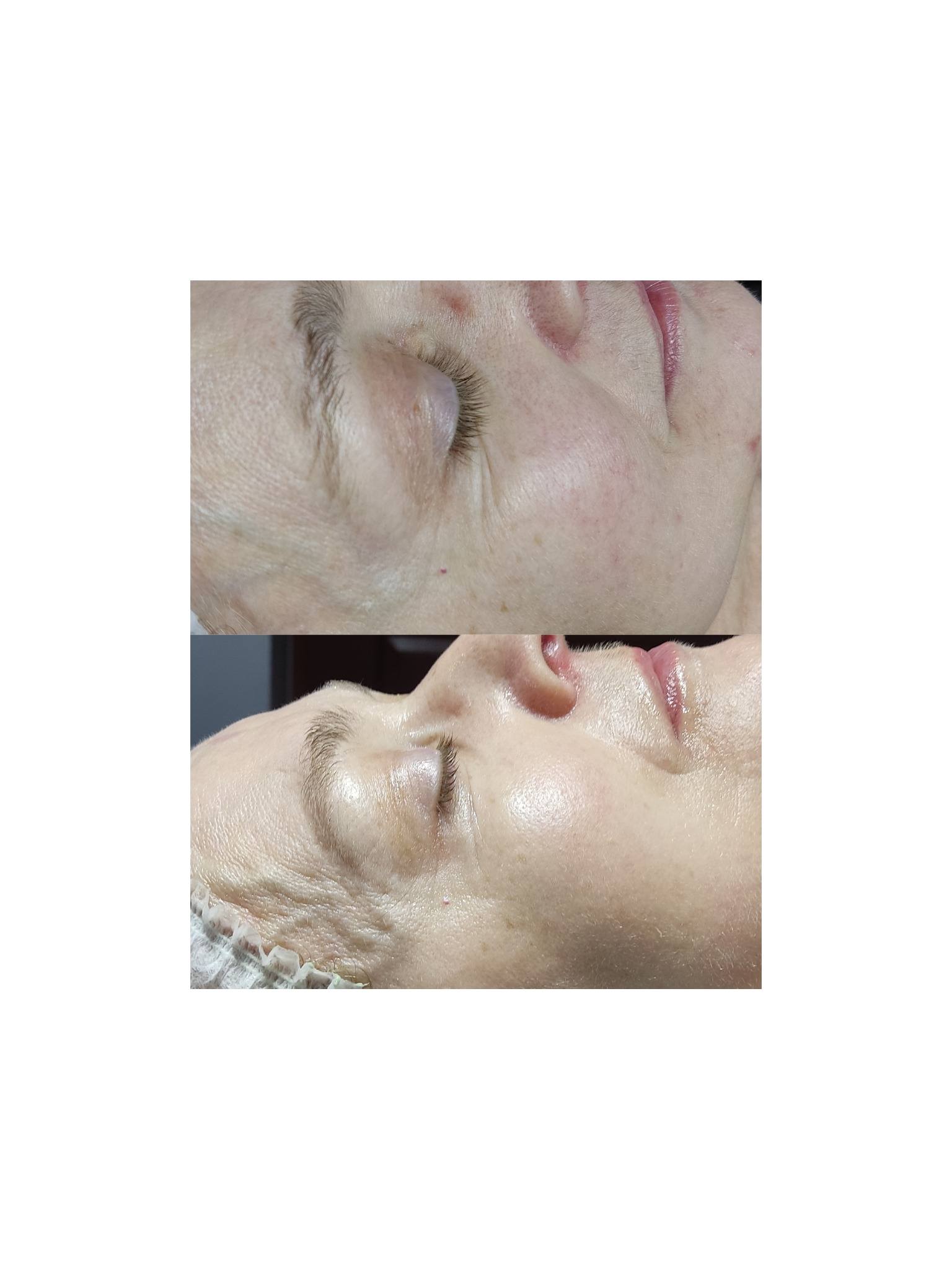 zabieg dermaorganic AT