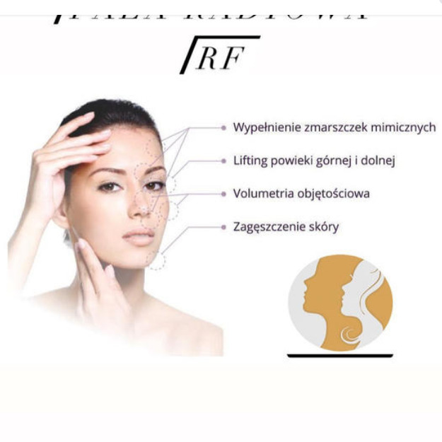 Grafika informacyjna prezentująca modelkę z zaznaczonymi obszarami na twarzy, na których wykonywane są zabiegi wypełniania zmarszczek mimicznych, liftingu powiek, wolumetrii i zagęszczania skóry...
