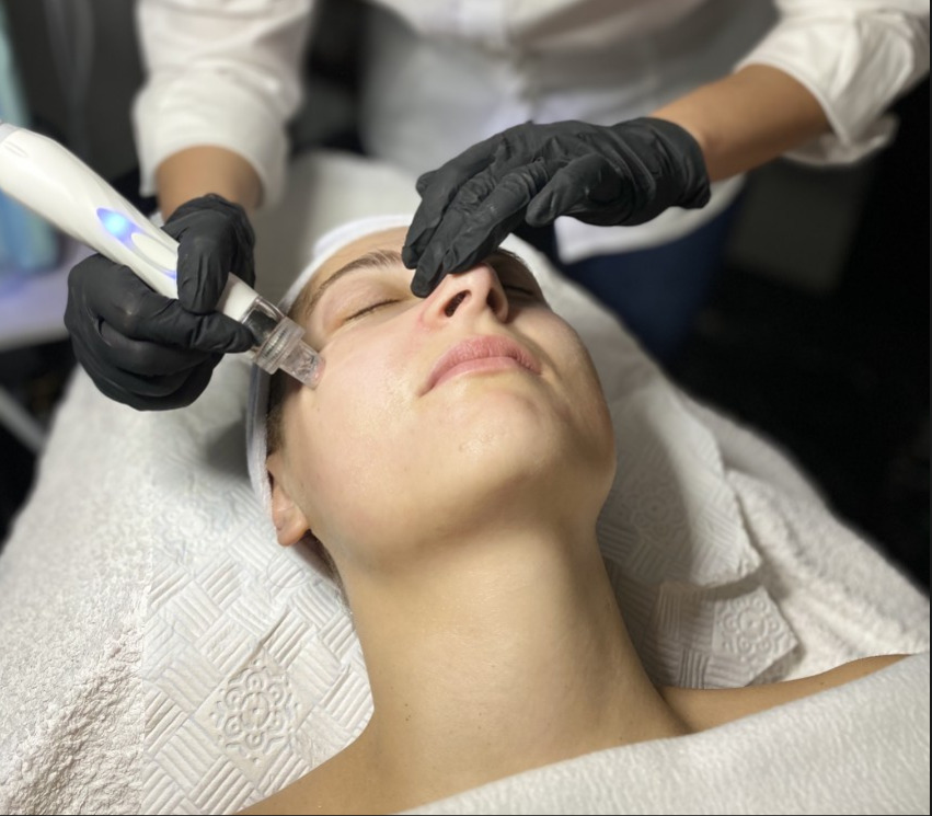 Wodorowe oczyszczanie twarzy