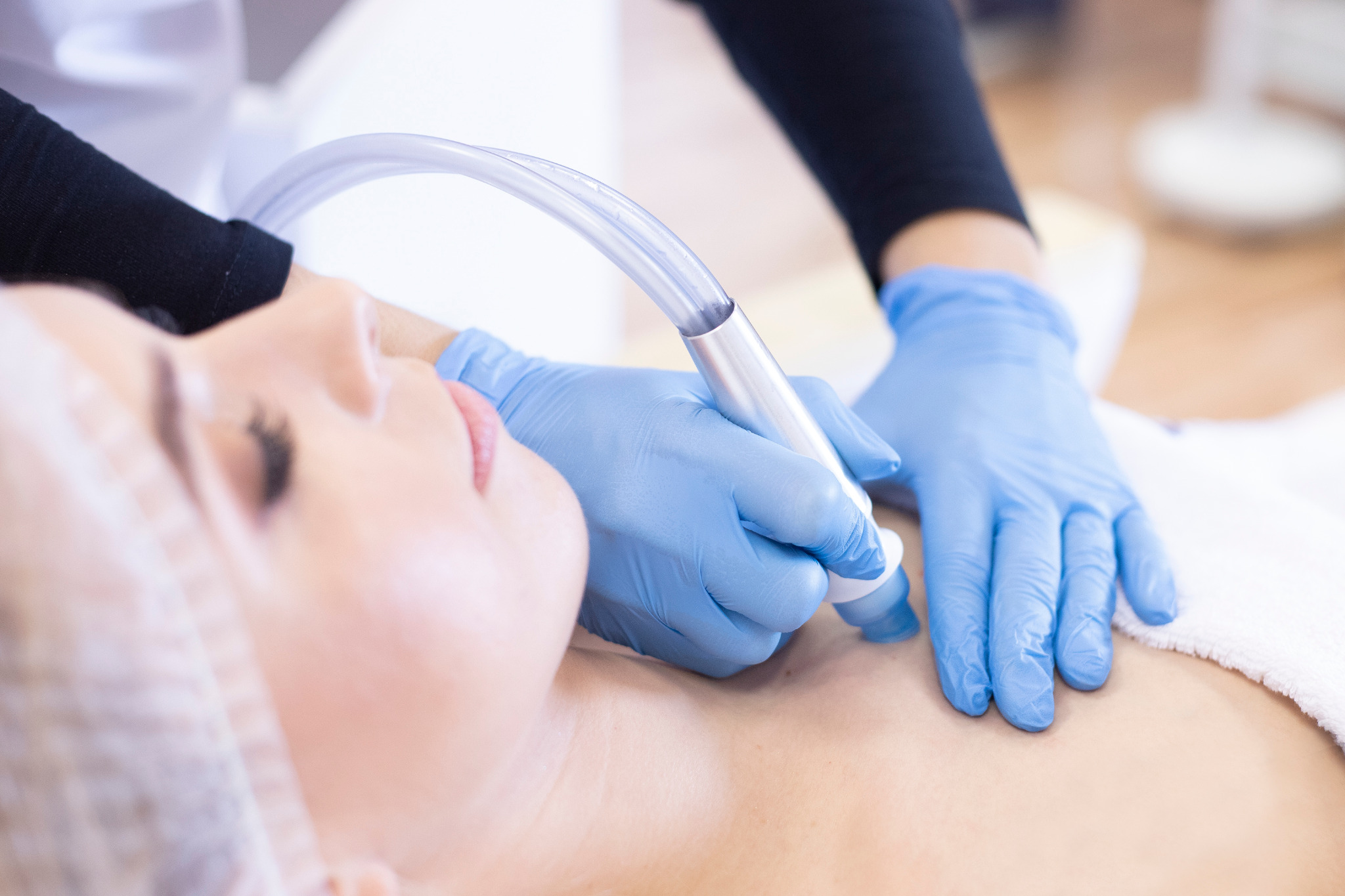 Kobieta leżąca na leżance poddawana zabiegowi na dekolcie za pomocą urządzenia z przezroczystą rurką, wykonywanemu przez osobę w niebieskich rękawiczkach.