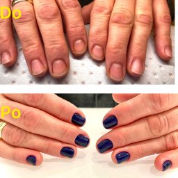 KOLOMAX Sp. z o.o. - Porównanie dłoni przed i po zabiegu: naturalne paznokcie przed stylizacją oraz pomalowane na ciemny, granatowy kolor z połyskiem.