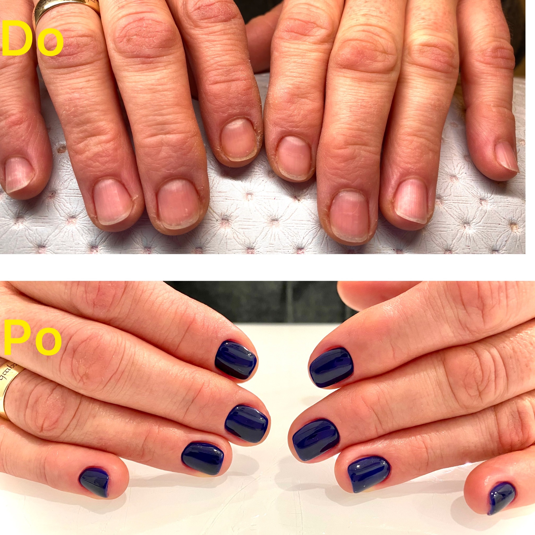 Porównanie dłoni przed i po zabiegu: naturalne paznokcie przed stylizacją oraz pomalowane na ciemny, granatowy kolor z połyskiem.