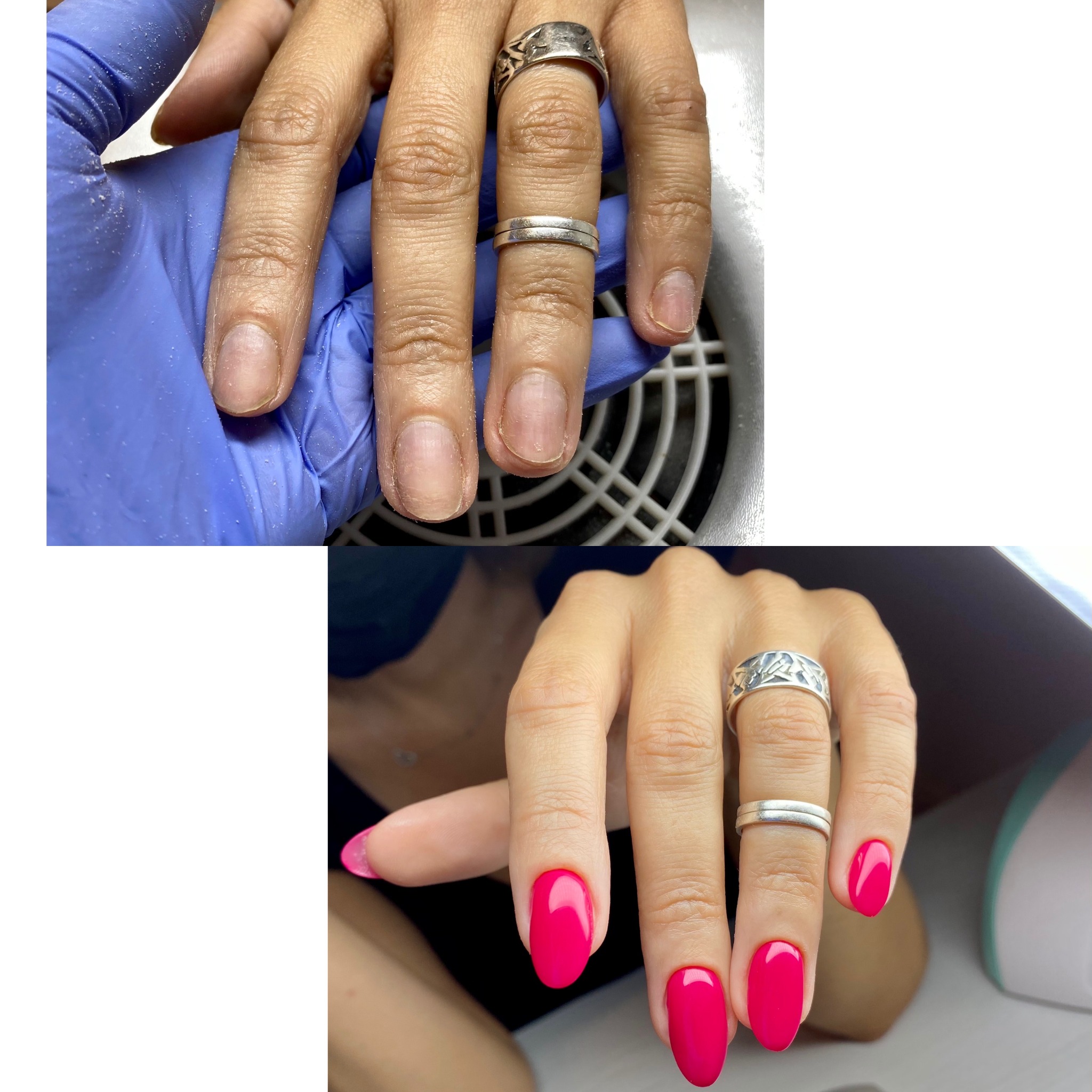 Dłoń w niebieskiej rękawiczce przed zabiegiem na tle białej pochłaniarki pyłu, oraz dłoń po zabiegu z pomalowanymi na różowo paznokciami w kształcie migdała, ozdobiona dwoma srebrnymi pierścionkami.