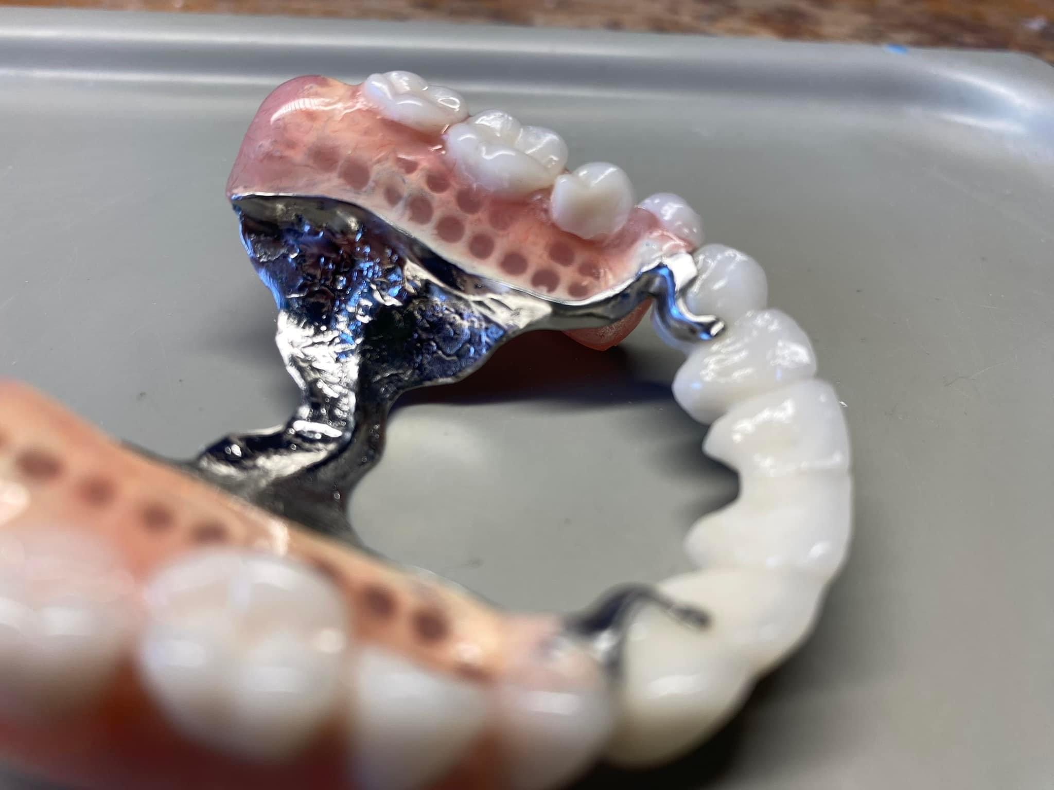 Wyjmowana proteza szkieletowa z akrylową płytą i metalowymi klamrami, widoczna z bliska na szarym tle.