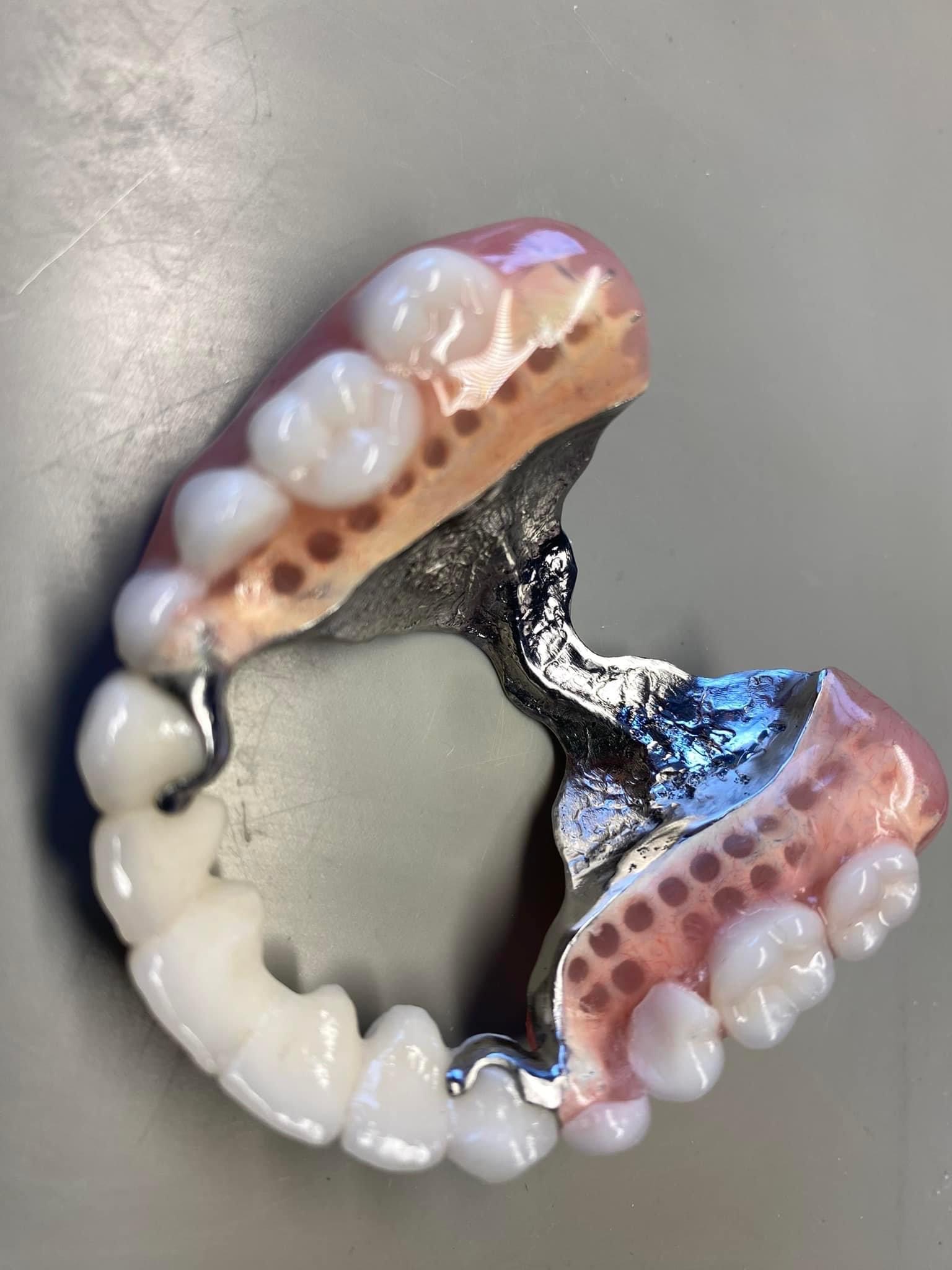 Wyjmowana proteza szkieletowa z metalową bazą i akrylowymi zębami, widoczne klamry i perforowana powierzchnia akrylu, ujęcie z góry na szarym tle.