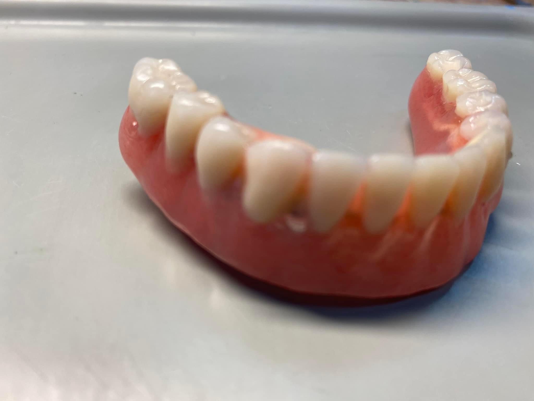 Górna proteza zębową na szarym podłożu, widoczne sztuczne zęby i różowa podstawa imitująca dziąsła, ujęcie z bliska.