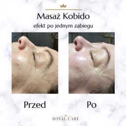 Medycyna estetyczna Opole 12
