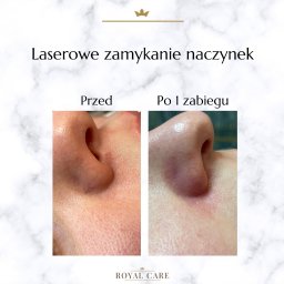 Medycyna estetyczna Opole 27