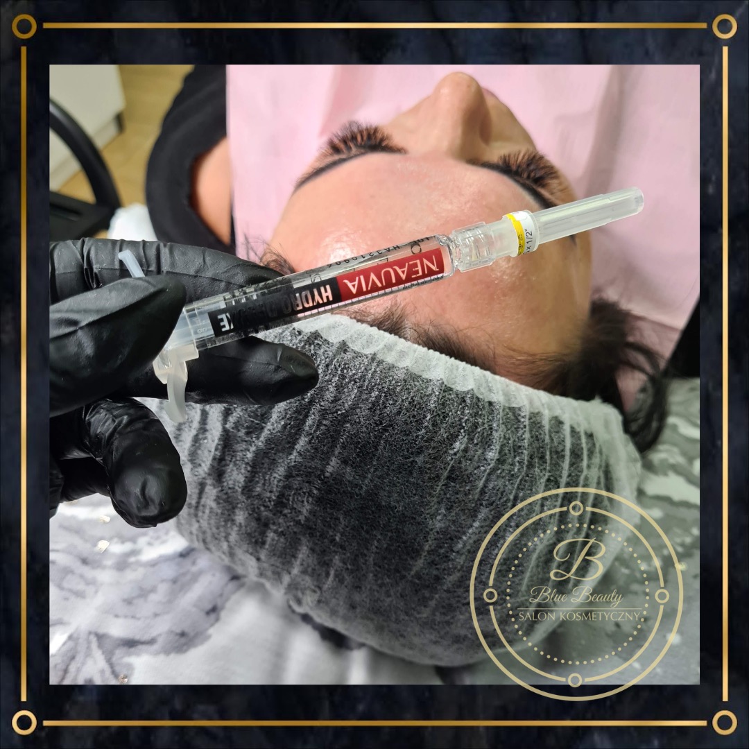 Górny widok twarzy kobiety przygotowanej do zabiegu, z igłą i strzykawką z preparatem Neauvia Hydro Deluxe w rękawicach, na tle salonu kosmetycznego z widocznym logo Blue Beauty.