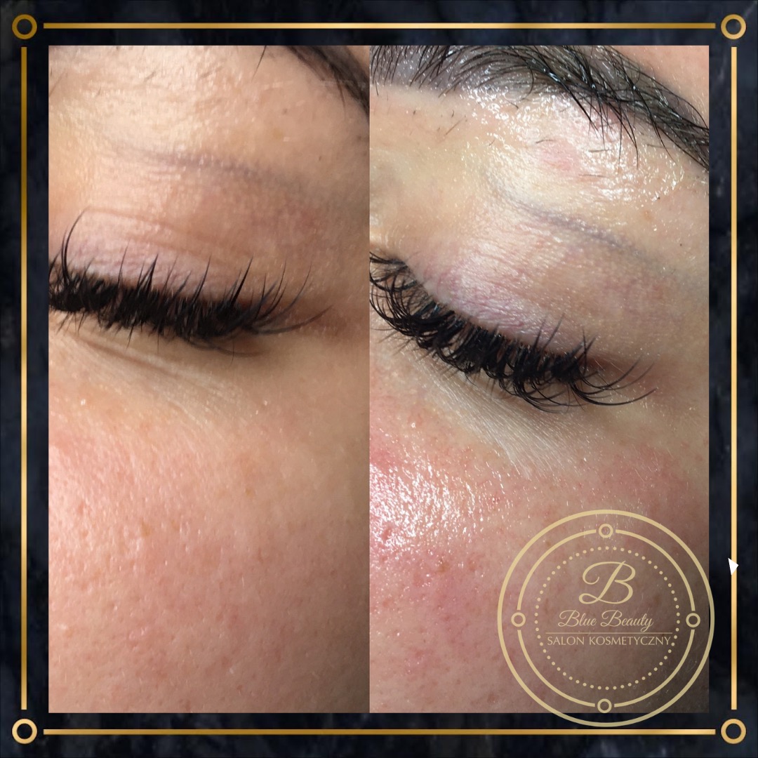 Zbliżenie na oko przed i po zabiegu przedłużania rzęs; po prawej stronie skóra lekko zaczerwieniona, widoczne logo salonu kosmetycznego w prawym dolnym rogu.