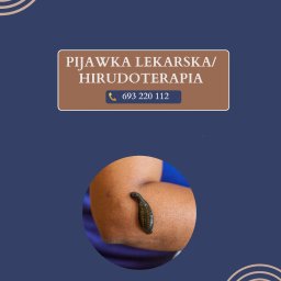 Fizjo Dusza Maciej Budek - Hirudoterapia: pijawka lekarska na ramieniu pacjenta, zbliżenie. Grafika z numerem telefonu i nazwą zabiegu na granatowym tle z dekoracyjnymi elementami.