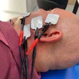 Elektrostymulacja w porażeniu nerwu twarzowego typu Bella