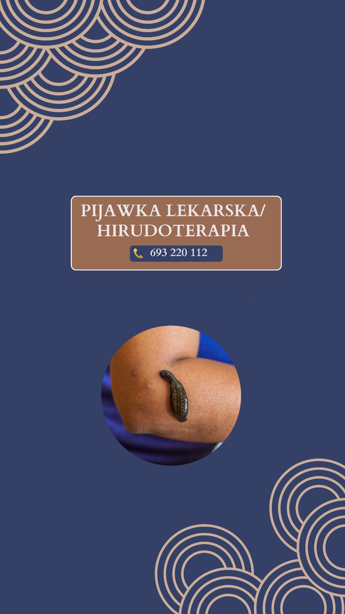 Hirudoterapia: pijawka lekarska na ramieniu pacjenta, zbliżenie. Grafika z numerem telefonu i nazwą zabiegu na granatowym tle z dekoracyjnymi elementami.