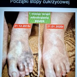 Rehabilitant Częstochowa 4