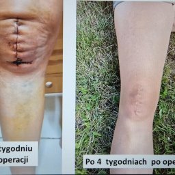 Rehabilitant Częstochowa 2